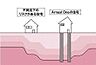 その他：【安心の土台作り】地盤調査結果に基づき地盤改良（補強）工事を実施。スウェーデン式サウンディング試験を行い、地盤調査データに基づき、この地盤の共通杭を選定し使用するなどして、地盤改良を行います